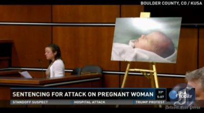 Unborn baby cut from womb